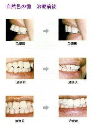 審美歯科の施術美容／専門クリニック