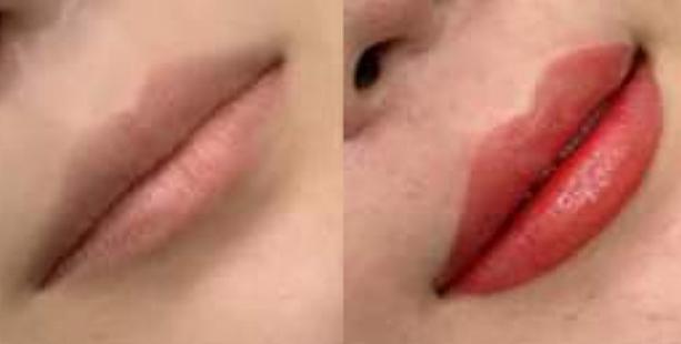 【PR】ビンセントクリニックの唇アートメイクで明るく若々しい口元に演出！ アートメイク 明洞 リップアート 唇アート ソウル韓国