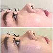 eye blow masic
眉毛パーマサンプル写真です。上が施術前で下が施術後です。
日本ではまだ主流ではない眉毛パーマ
