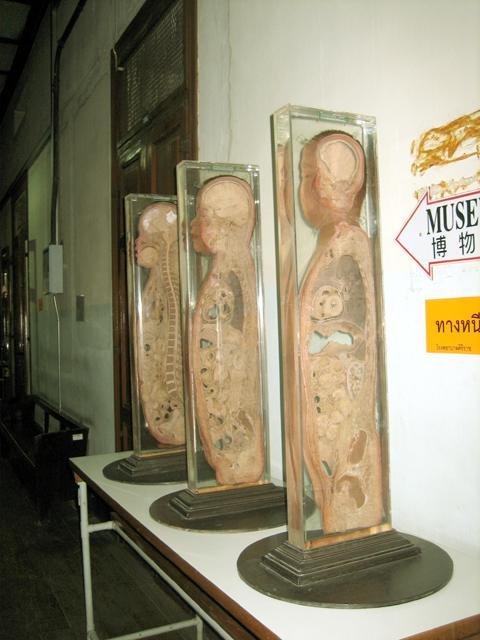 シリラート死体博物館 Siriraj Medical Museum バンコクナビ