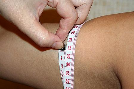 施術前の右腕は31cm、左腕は32cm