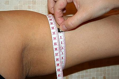 施術前の右腕は31cm、左腕は32cm