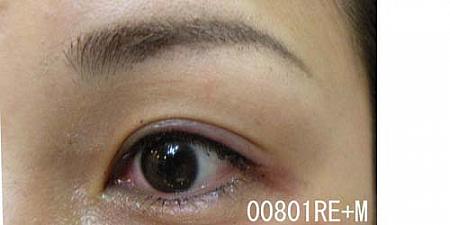 眉毛リタッチ、アイラインの施術直後