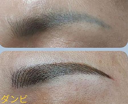 コンボ眉 施術前（上）<br>コンボ眉 施術後