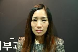 施術前（一応メイクしてます…）