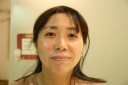 【※掲載終了】ヘドゥリン韓医院 ダイエット 漢方ダイエット 漢方エステ 漢方スキンケア ニキビ治療韓国エステ
