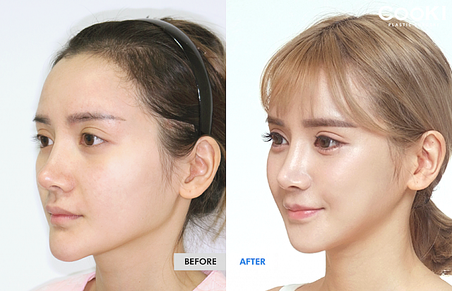 クッキー整形外科 Cooki整形外科 エステ予約 ソウルナビ