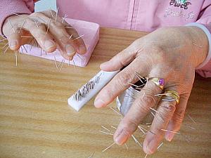 韓国で広く知られている民間療法、高麗手指鍼（コリョスジチム）！