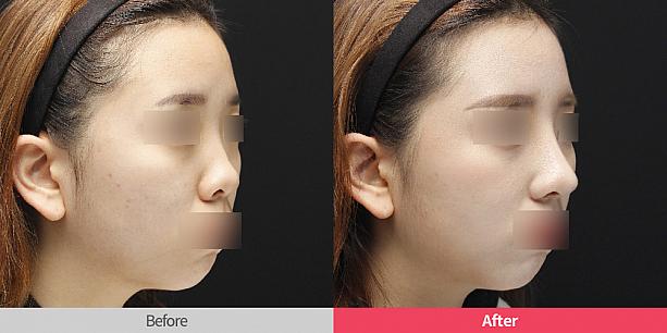 【PR】ソウルリスタ整形外科を詳しく見てみよう！ 整形 鼻整形 美鼻 だんご鼻 わし鼻美容外科クリニック