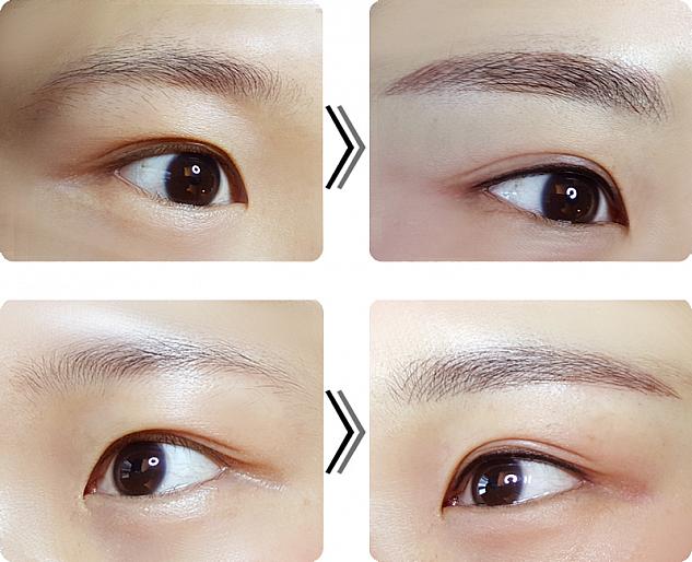 Pr 日本人の満足度も高い 皮膚科内のアートメイクセンター メイライン で自然な眉ラインをゲット ソウルナビ