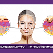 【PR】リノボ皮膚科で小じわをなくす！！ 皮膚科クリニック 美容クリニック／専門クリニックボトックス
