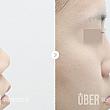 【PR】ウィーバー美容外科の突出した口鼻整形～！美容外科クリニック