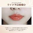 【PR】ライク整形外科の口元整形！人中&唇の悩みをしっかり解決してくれます。 唇整形 人中 美容整形外科 江南 日本語可能 アンチエイジング Cカール M字 口角美容整形
