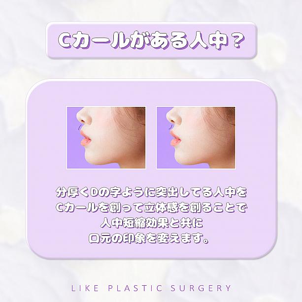【PR】ライク整形外科の人中の溝をCカールに！ ソウル美容整形 人中 美容外科美容整形