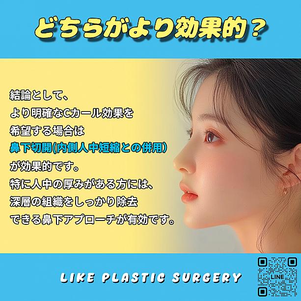 【PR】Cカール形成、どちらの切開法がベスト？！ ソウル美容整形 整形 美容 口元アンチエイジング