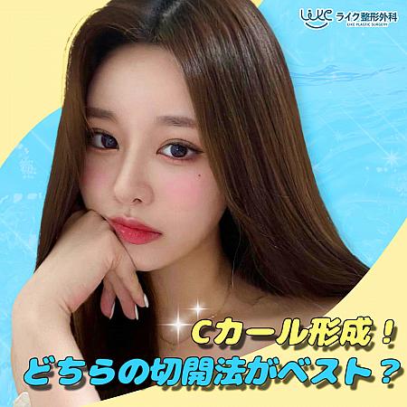 【PR】Cカール形成、どちらの切開法がベスト？！ ソウル美容整形 整形 美容 口元アンチエイジング