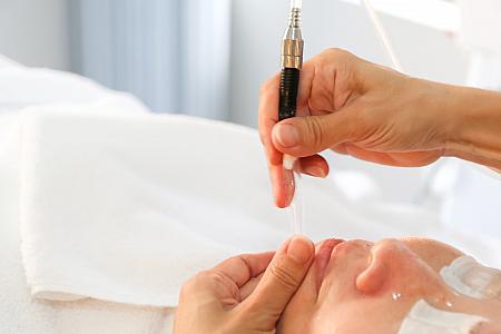 吸われている感じはあれど痛みはなし